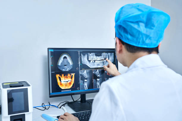 Best Emergency Tooth Extraction in Kensington, CA